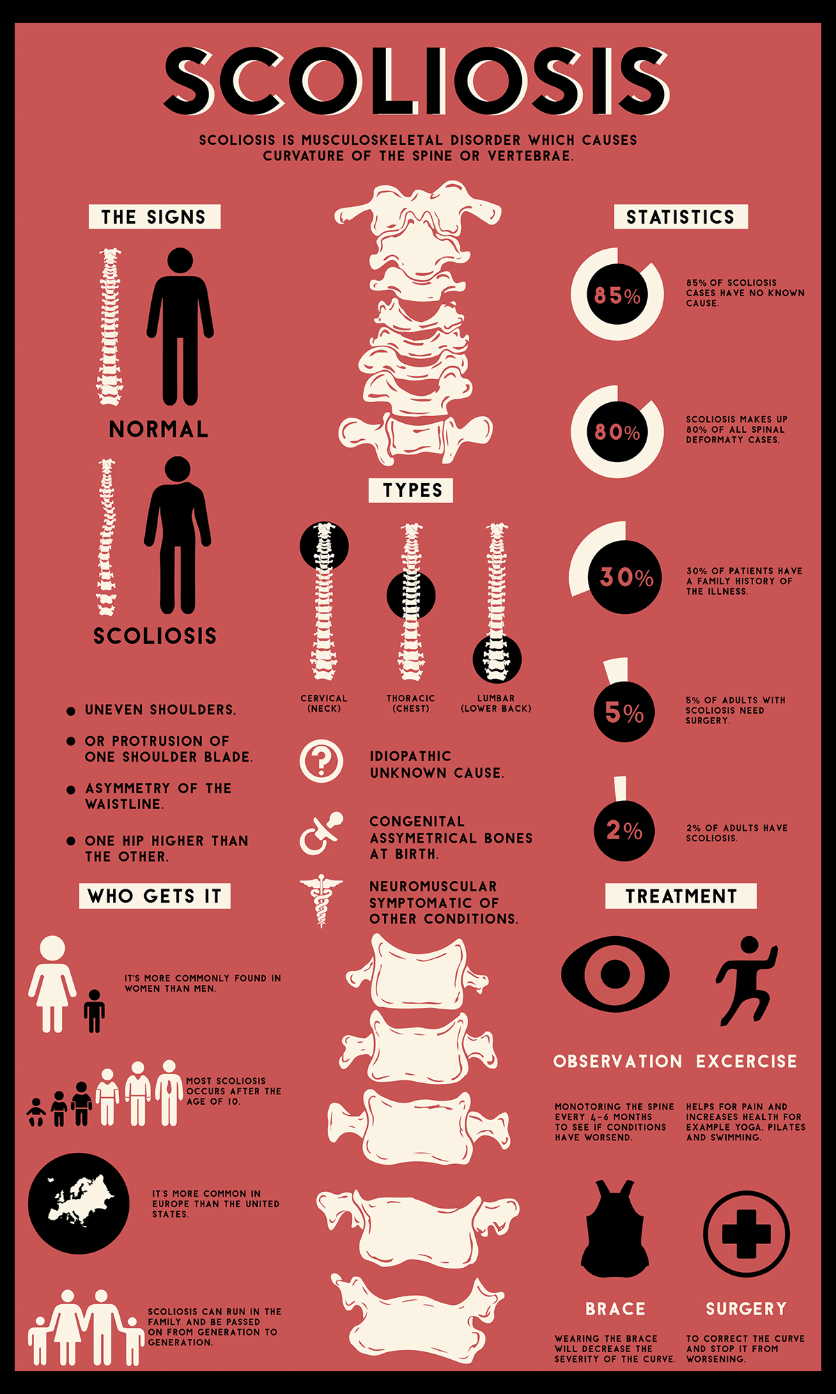 Infographic Scoliose, een scheve aandoening 