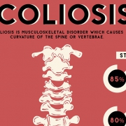 Scoliosis infographic thumbnail